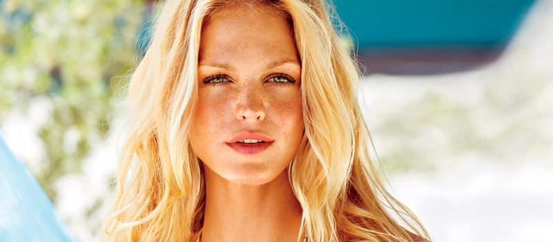 Freckles: Why Do They Appear and How to Reduce Their Visibility - Women ...