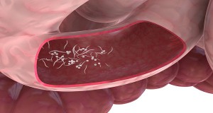 10 Early Signs That Indicate You Have Parasites in Your Digestive ...