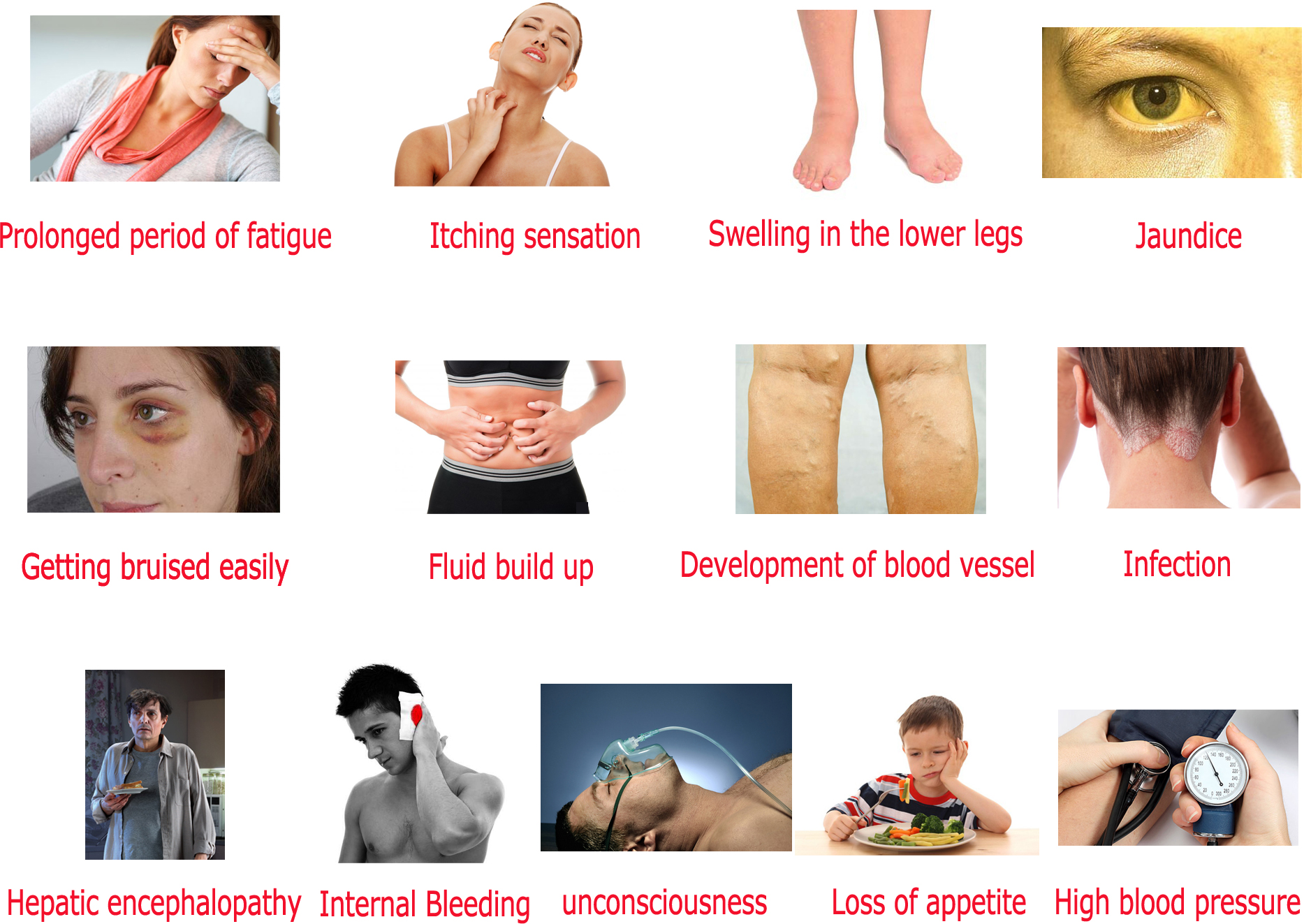 Liver Damage Signs And Symptoms