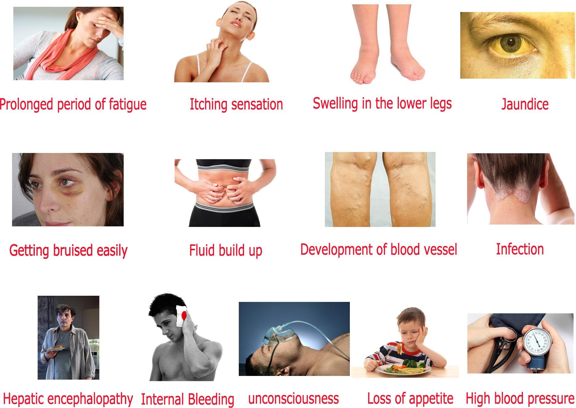 21 Signs That Indicate Your Liver Doesn t Function Efficiently Women 