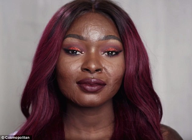 Brave Girl With Burn Scars On Her Face Does Incredible Makeup Tutorials