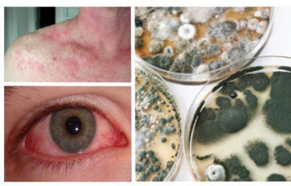 21 Early Warning Signs Of Mold Toxicity And How To Get Rid Of It 