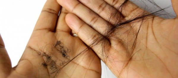 6 Reasons Why Your Hair Is Shedding More Than Normal Women Daily Magazine   6 Reasons Why Your Hair Is Shedding More Than Normal 600x263 