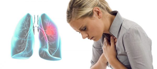 Respiratory Problems and Physiotherapy - Women Daily Magazine