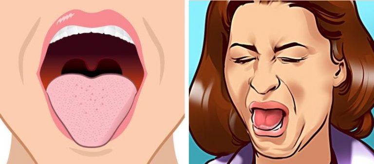 bitter-taste-in-your-mouth-how-do-i-get-rid-of-it